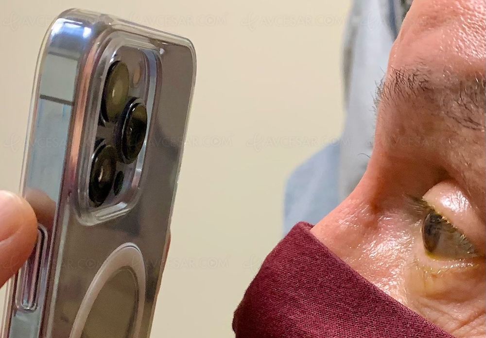 iPhone 13 Pro, nouvel instrument des&nbsp;ophtalmos&nbsp;?