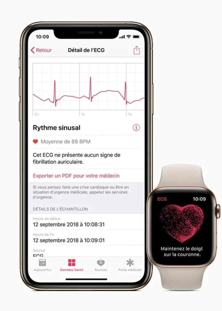 Crise cardiaque évitée, merci l'Apple&nbsp;Watch