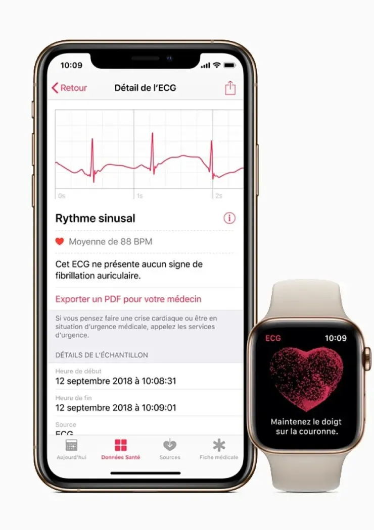 crise-cardiaque-evitee-merci-l-apple-watch