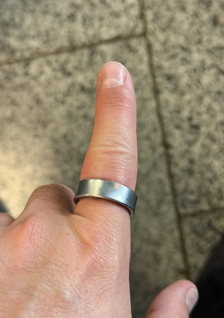 galaxy-ring-qui-enfle-a-un-doigt-de-la-cata