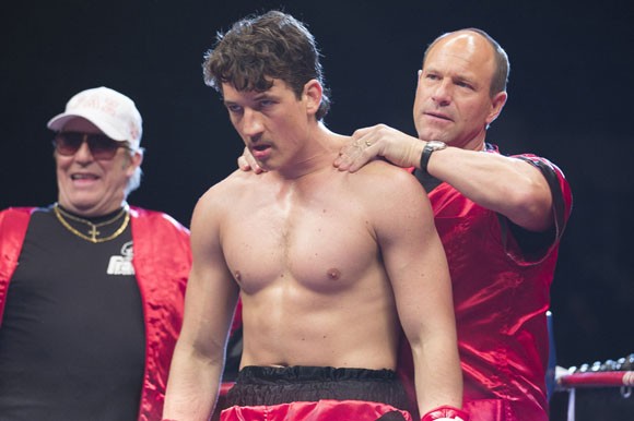 Bleed for this